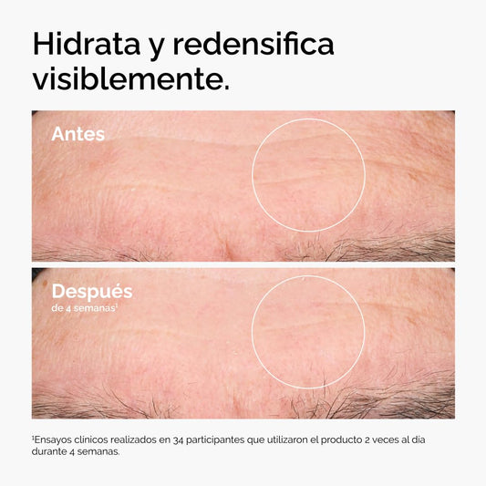 The Ordinary Hyaluronic Acid 2% + B5 (with Ceramides), Hyaluronic Acid + B5 (with Ceramides), Multidimensional Moisturizing Serum for Softer, Smoother Skin 30ml