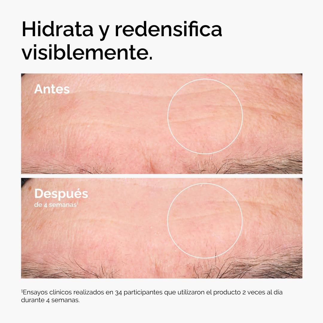 The Ordinary Hyaluronic Acid 2% + B5 (with Ceramides), Hyaluronic Acid + B5 (with Ceramides), Multidimensional Moisturizing Serum for Softer, Smoother Skin 30ml